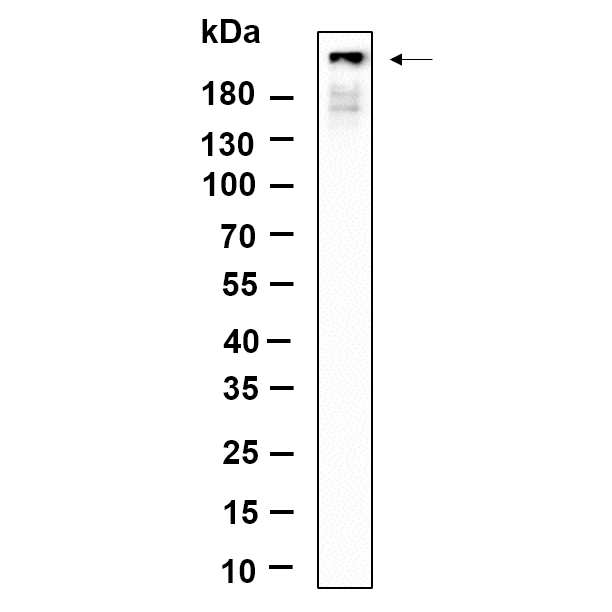 WR4605 Western Blot analysis using Hela lysates,primary antibody was diluted at 1:1000, 4°over night, Dylight 800 secondary antibody(WS0446)was diluted at 1:10000, 37° 1hour. Western Blot analysis using Hela lysates,primary antibody was diluted at 1:1000, 4°over night, Dylight 800 secondary antibody(WS0446)was diluted at 1:10000, 37° 1hour.