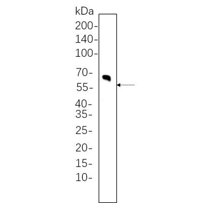 Rat brain whole cell lysates were separated by 10% SDS-PAGE, and the membrane was blotted with primary antibody(1:1000). The HRP-conjugated Goat anti-Rabbit IgG(H + L) antibody was used to detect the antibody.