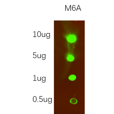 Western Blot analysis using M6a,primary antibody was diluted at 1:1000, 4°over night, Dylight 800 secondary antibody(WS0446)was diluted at 1:10000, 37° 1hour.