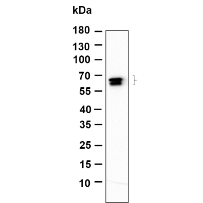 Western Blot analysis using Rat brain lysates,primary antibody was diluted at 1:1000, 4°over night, Dylight 800 secondary antibody(WS0446)was diluted at 1:10000, 37° 1hour.