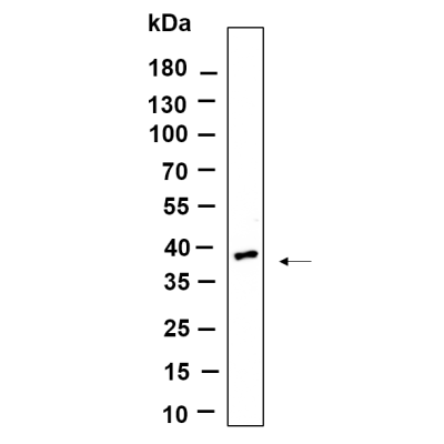 Western Blot analysis using Rat brain lysates,primary antibody was diluted at 1:1000, 4°over night, Dylight 800 secondary antibody(WS0446)was diluted at 1:10000, 37° 1hour.