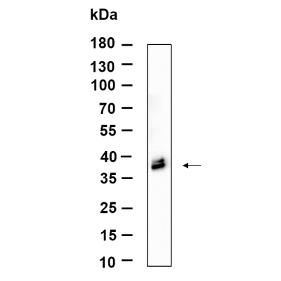 Western Blot analysis using Rat liver lysates,primary antibody was diluted at 1:1000, 4°over night, Dylight 800 secondary antibody(WS0446)was diluted at 1:10000, 37° 1hour.