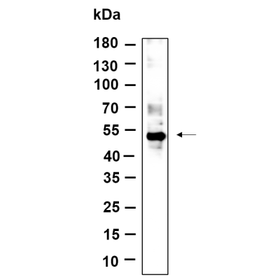 Western Blot analysis using HEK293 was treated with Calyculin A(100nM) for 1 hour lysates,primary antibody was diluted at 1:1000, 4°over night, Dylight 800 secondary antibody(WS0446)was diluted at 1:10000, 37° 1hour.