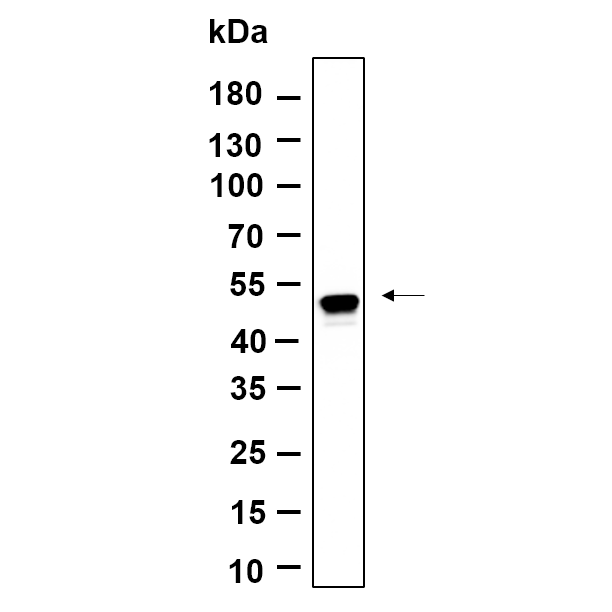 WR4635 Western Blot analysis using HT-1080 serum was starved overnight and treated with TGF-β3(10ng/ml) for 30 minutes lysates,primary antibody was diluted at 1:1000, 4°over night, Dylight 800 secondary antibody(WS0446)was diluted at 1:10000, 37° 1hour. Western Blot analysis using HT-1080 serum was starved overnight and treated with TGF-β3(10ng/ml) for 30 minutes lysates,primary antibody was diluted at 1:1000, 4°over night, Dylight 800 secondary antibody(WS0446)was diluted at 1:10000, 37° 1hour.