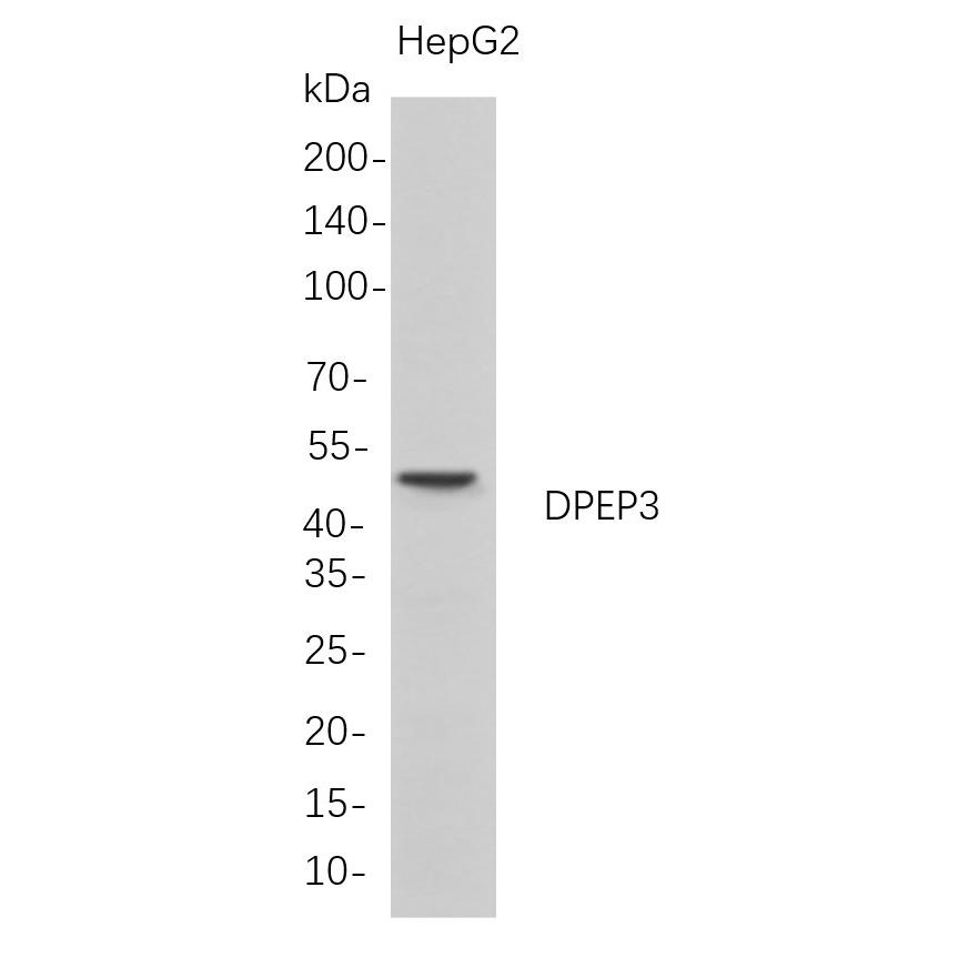 WR4645 Western Blot analysis of HepG2 whole cell lysates were separated by 4-20% SDS-PAGE, and the membrane was blotted with anti-DPEP3 rabbit mAb. The HRP-conjugated Goat anti-Rabbit IgG(H + L) antibody was used to detect the antibody. Western Blot analysis of HepG2 whole cell lysates were separated by 4-20% SDS-PAGE, and the membrane was blotted with anti-DPEP3 rabbit mAb. The HRP-conjugated Goat anti-Rabbit IgG(H + L) antibody was used to detect the antibody.
