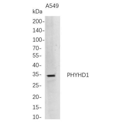 Western Blot analysis of A549 whole cell lysates were separated by 4-20% SDS-PAGE, and the membrane was blotted with anti-PHYHD1 rabbit mAb. The HRP-conjugated Goat anti-Rabbit IgG(H + L) antibody was used to detect the antibody.
