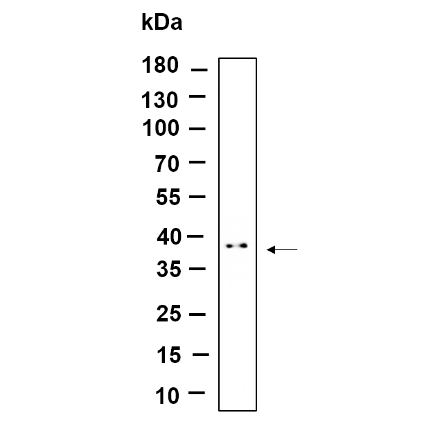 WR4653 Western Blot analysis using K562 lysates,primary antibody was diluted at 1:1000, 4°over night, Dylight 800 secondary antibody(WS0446)was diluted at 1:10000, 37° 1hour. Western Blot analysis using K562 lysates,primary antibody was diluted at 1:1000, 4°over night, Dylight 800 secondary antibody(WS0446)was diluted at 1:10000, 37° 1hour.