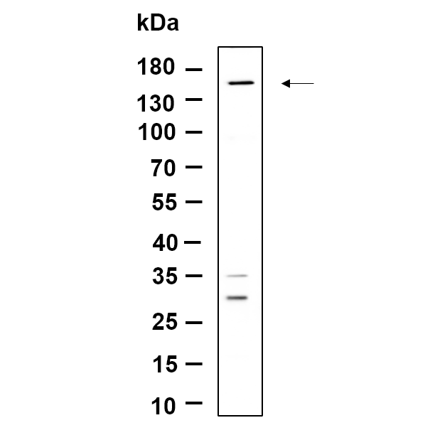 WR4660 Western Blot analysis using Hela lysates,primary antibody was diluted at 1:1000, 4°over night, Dylight 800 secondary antibody(WS0446)was diluted at 1:10000, 37° 1hour. Western Blot analysis using Hela lysates,primary antibody was diluted at 1:1000, 4°over night, Dylight 800 secondary antibody(WS0446)was diluted at 1:10000, 37° 1hour.