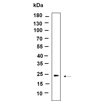Western Blot analysis using Rat liver lysates,primary antibody was diluted at 1:1000, 4°over night, Dylight 800 secondary antibody(WS0446)was diluted at 1:10000, 37° 1hour.
