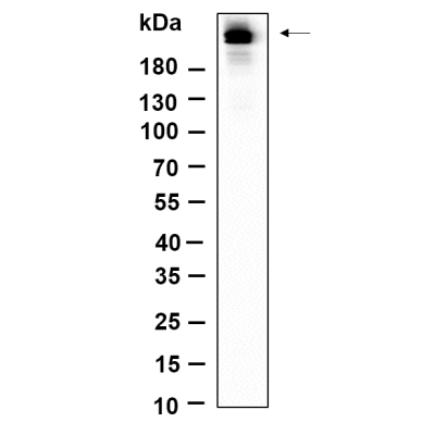 Western Blot analysis using NIH-3T3 was treated with TSA(400nM) for 18 hours lysates,primary antibody was diluted at 1:1000, 4°over night, Dylight 800 secondary antibody(WS0446)was diluted at 1:10000, 37° 1hour.