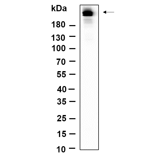 WR4662 Western Blot analysis using NIH-3T3 was treated with TSA(400nM) for 18 hours lysates,primary antibody was diluted at 1:1000, 4°over night, Dylight 800 secondary antibody(WS0446)was diluted at 1:10000, 37° 1hour. Western Blot analysis using NIH-3T3 was treated with TSA(400nM) for 18 hours lysates,primary antibody was diluted at 1:1000, 4°over night, Dylight 800 secondary antibody(WS0446)was diluted at 1:10000, 37° 1hour.