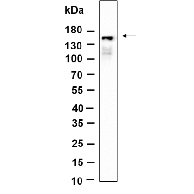 Western Blot analysis using Hela was treated with Pervanadate(10mM) for 1 hour lysates,primary antibody was diluted at 1:1000, 4°over night, Dylight 800 secondary antibody(WS0446)was diluted at 1:10000, 37° 1hour.
