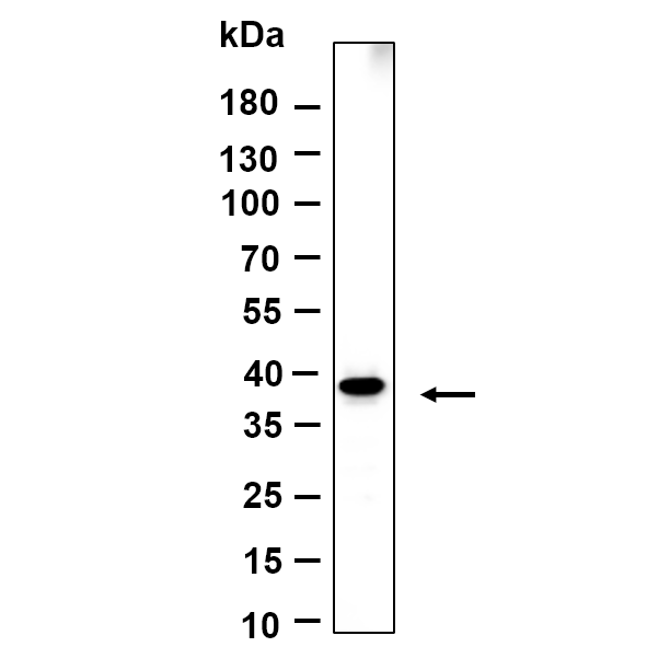 WR4668 Western Blot analysis using DU145 lysates,primary antibody was diluted at 1:1000, 4°over night, Dylight 800 secondary antibody(WS0446)was diluted at 1:10000, 37° 1hour. Western Blot analysis using DU145 lysates,primary antibody was diluted at 1:1000, 4°over night, Dylight 800 secondary antibody(WS0446)was diluted at 1:10000, 37° 1hour.