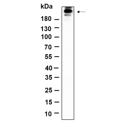 Western Blot analysis using C6 was treated with oligomycin(0.5μM) for 30 minutes lysates,primary antibody was diluted at 1:1000, 4°over night, Dylight 800 secondary antibody(WS0446)was diluted at 1:10000, 37° 1hour.