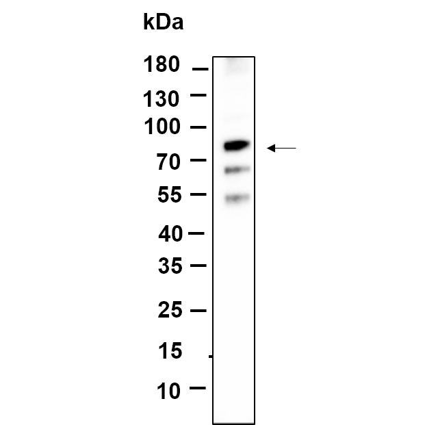 WR4676 Western Blot analysis using SW480 lysates,primary antibody was diluted at 1:1000, 4°over night, Dylight 800 secondary antibody(WS0446)was diluted at 1:10000, 37° 1hour. Western Blot analysis using SW480 lysates,primary antibody was diluted at 1:1000, 4°over night, Dylight 800 secondary antibody(WS0446)was diluted at 1:10000, 37° 1hour.