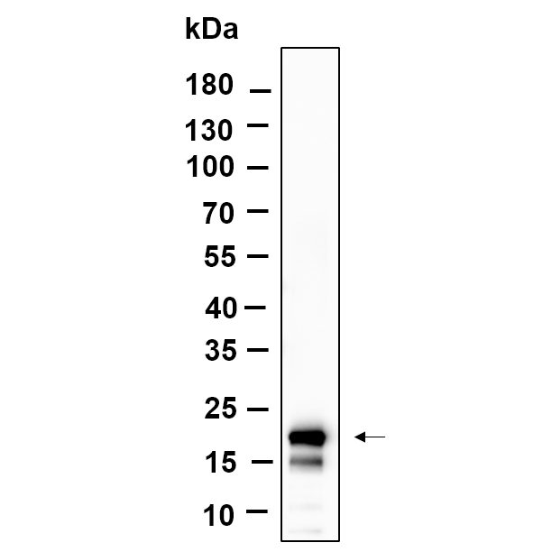 WR4678 Western Blot analysis using C6 was treated with TSA (500ng/mL) for 4 hours lysates,primary antibody was diluted at 1:1000, 4°over night, Dylight 800 secondary antibody(WS0446)was diluted at 1:10000, 37° 1hour. Western Blot analysis using C6 was treated with TSA (500ng/mL) for 4 hours lysates,primary antibody was diluted at 1:1000, 4°over night, Dylight 800 secondary antibody(WS0446)was diluted at 1:10000, 37° 1hour.