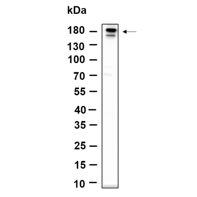 Western Blot analysis using T47D was treated with hNRG-1(100ng/ml) for 15 minutes lysates,primary antibody was diluted at 1:1000, 4°over night, Dylight 800 secondary antibody(WS0446)was diluted at 1:10000, 37° 1hour.