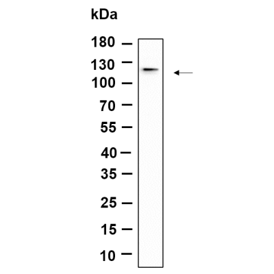 Western Blot analysis using T47D lysates,primary antibody was diluted at 1:1000, 4°over night, Dylight 800 secondary antibody(WS0446)was diluted at 1:10000, 37° 1hour.