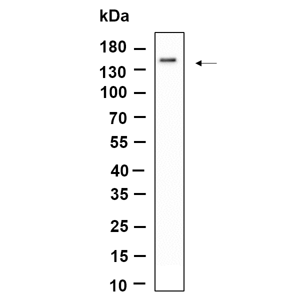 WR4688 Western Blot analysis using Jurkat lysates,primary antibody was diluted at 1:1000, 4°over night, Dylight 800 secondary antibody(WS0446)was diluted at 1:10000, 37° 1hour. Western Blot analysis using Jurkat lysates,primary antibody was diluted at 1:1000, 4°over night, Dylight 800 secondary antibody(WS0446)was diluted at 1:10000, 37° 1hour.