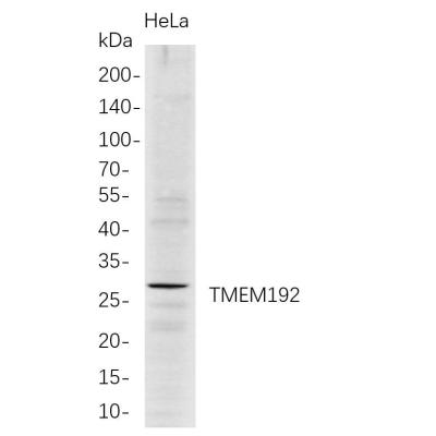 Western Blot analysis of HeLa whole cell lysates were separated by 4-20% SDS-PAGE, and the membrane was blotted with anti-TMEM192 rabbit mAb. The HRP-conjugated Goat anti-Rabbit IgG(H + L) antibody was used to detect the antibody.