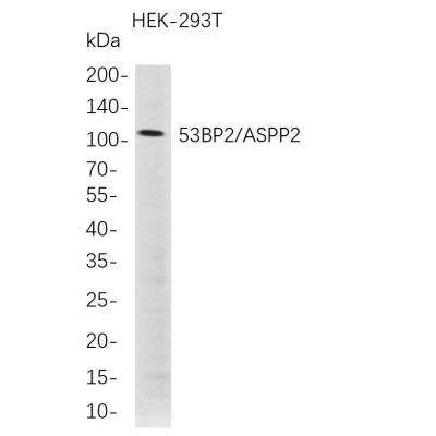 Western Blot analysis of HEK-293T whole cell lysates were separated by 4-20% SDS-PAGE, and the membrane was blotted with anti-53BP2/ASPP2 rabbit mAb. The HRP-conjugated Goat anti-Rabbit IgG(H + L) antibody was used to detect the antibody.