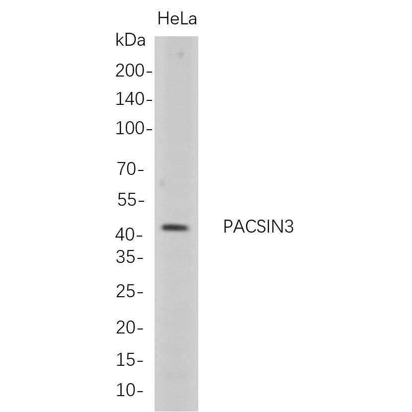 WR4700 Western Blot analysis of HeLa whole cell lysates were separated by 4-20% SDS-PAGE, and the membrane was blotted with anti-PACSIN3 rabbit mAb. The HRP-conjugated Goat anti-Rabbit IgG(H + L) antibody was used to detect the antibody. Western Blot analysis of HeLa whole cell lysates were separated by 4-20% SDS-PAGE, and the membrane was blotted with anti-PACSIN3 rabbit mAb. The HRP-conjugated Goat anti-Rabbit IgG(H + L) antibody was used to detect the antibody.