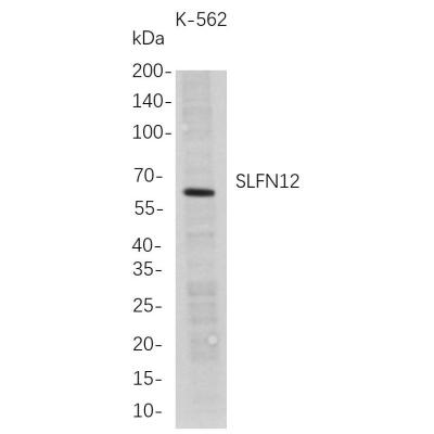 Western Blot analysis of K-562 whole cell lysates were separated by 4-20% SDS-PAGE, and the membrane was blotted with anti-SLFN12 rabbit mAb. The HRP-conjugated Goat anti-Rabbit IgG(H + L) antibody was used to detect the antibody.