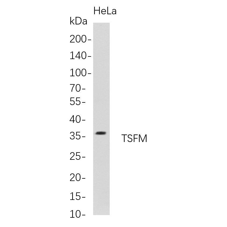 WR4713 Western Blot analysis of HeLa whole cell lysates were separated by 4-20% SDS-PAGE, and the membrane was blotted with anti-TSFM rabbit mAb. The HRP-conjugated Goat anti-Rabbit IgG(H + L) antibody was used to detect the antibody. Western Blot analysis of HeLa whole cell lysates were separated by 4-20% SDS-PAGE, and the membrane was blotted with anti-TSFM rabbit mAb. The HRP-conjugated Goat anti-Rabbit IgG(H + L) antibody was used to detect the antibody.