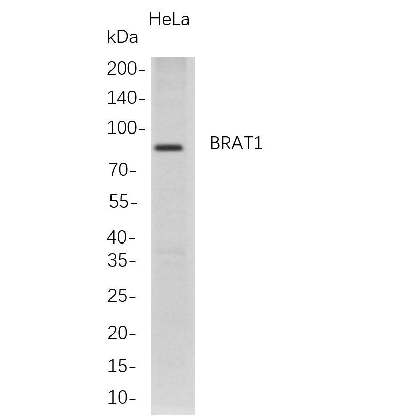 WR4716 Western Blot analysis of HeLa whole cell lysates were separated by 4-20% SDS-PAGE, and the membrane was blotted with anti-BRAT1 rabbit mAb. The HRP-conjugated Goat anti-Rabbit IgG(H + L) antibody was used to detect the antibody. Western Blot analysis of HeLa whole cell lysates were separated by 4-20% SDS-PAGE, and the membrane was blotted with anti-BRAT1 rabbit mAb. The HRP-conjugated Goat anti-Rabbit IgG(H + L) antibody was used to detect the antibody.