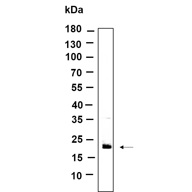 WR4746 Western Blot analysis using HEK293 lysates,primary antibody was diluted at 1:1000, 4°over night, Dylight 800 secondary antibody(WS0446)was diluted at 1:10000, 37° 1hour. Western Blot analysis using HEK293 lysates,primary antibody was diluted at 1:1000, 4°over night, Dylight 800 secondary antibody()was diluted at 1:10000, 37° 1hour.
