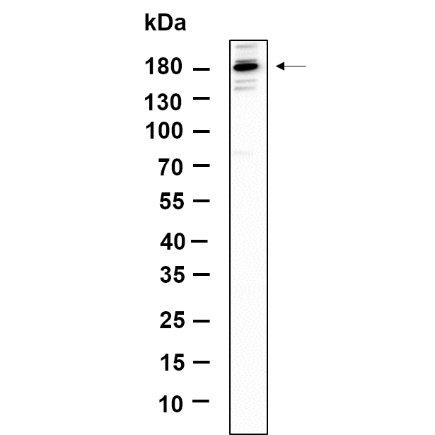 WR4751 Western Blot analysis using K562 lysates,primary antibody was diluted at 1:1000, 4°over night, Dylight 800 secondary antibody(WS0446)was diluted at 1:10000, 37° 1hour. Western Blot analysis using K562 lysates,primary antibody was diluted at 1:1000, 4°over night, Dylight 800 secondary antibody(WS0446)was diluted at 1:10000, 37° 1hour.
