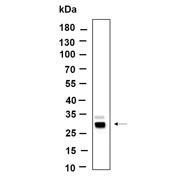 WR4771 Western Blot analysis using HUVEC lysates,primary antibody was diluted at 1:1000, 4°over night, Dylight 800 secondary antibody(WS0446)was diluted at 1:10000, 37° 1hour. Western Blot analysis using HUVEC lysates,primary antibody was diluted at 1:1000, 4°over night, Dylight 800 secondary antibody(WS0446)was diluted at 1:10000, 37° 1hour.