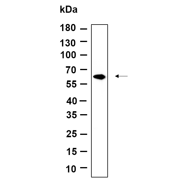 WR4773 Western Blot analysis using Jurkat lysates,primary antibody was diluted at 1:1000, 4°over night, Dylight 800 secondary antibody(WS0446)was diluted at 1:10000, 37° 1hour. Western Blot analysis using Jurkat lysates,primary antibody was diluted at 1:1000, 4°over night, Dylight 800 secondary antibody(WS0446)was diluted at 1:10000, 37° 1hour.