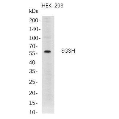Western Blot analysis of HEK-293 whole cell lysates were separated by 4-20% SDS-PAGE, and the membrane was blotted with anti-SGSH rabbit mAb. The HRP-conjugated Goat anti-Rabbit IgG(H + L) antibody was used to detect the antibody.