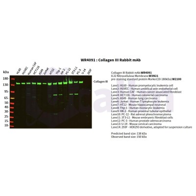 Various whole cell lysates were separated by 4-20% SDS-PAGE, and the primary antibody was used at 4°C, over night with a 1:5000 dilution . The Dylight 800-conjugated Goat anti-Rabbit antibody(Cat:WS0446) was used to detect the antibody.