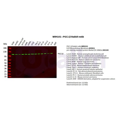 Various whole cell lysates were separated by 4-20% SDS-PAGE, and the primary antibody was used at 4°C, over night with a 1:2500 dilution . The Dylight 800-conjugated Goat anti-Rabbit antibody(Cat:WS0446) was used to detect the antibody.