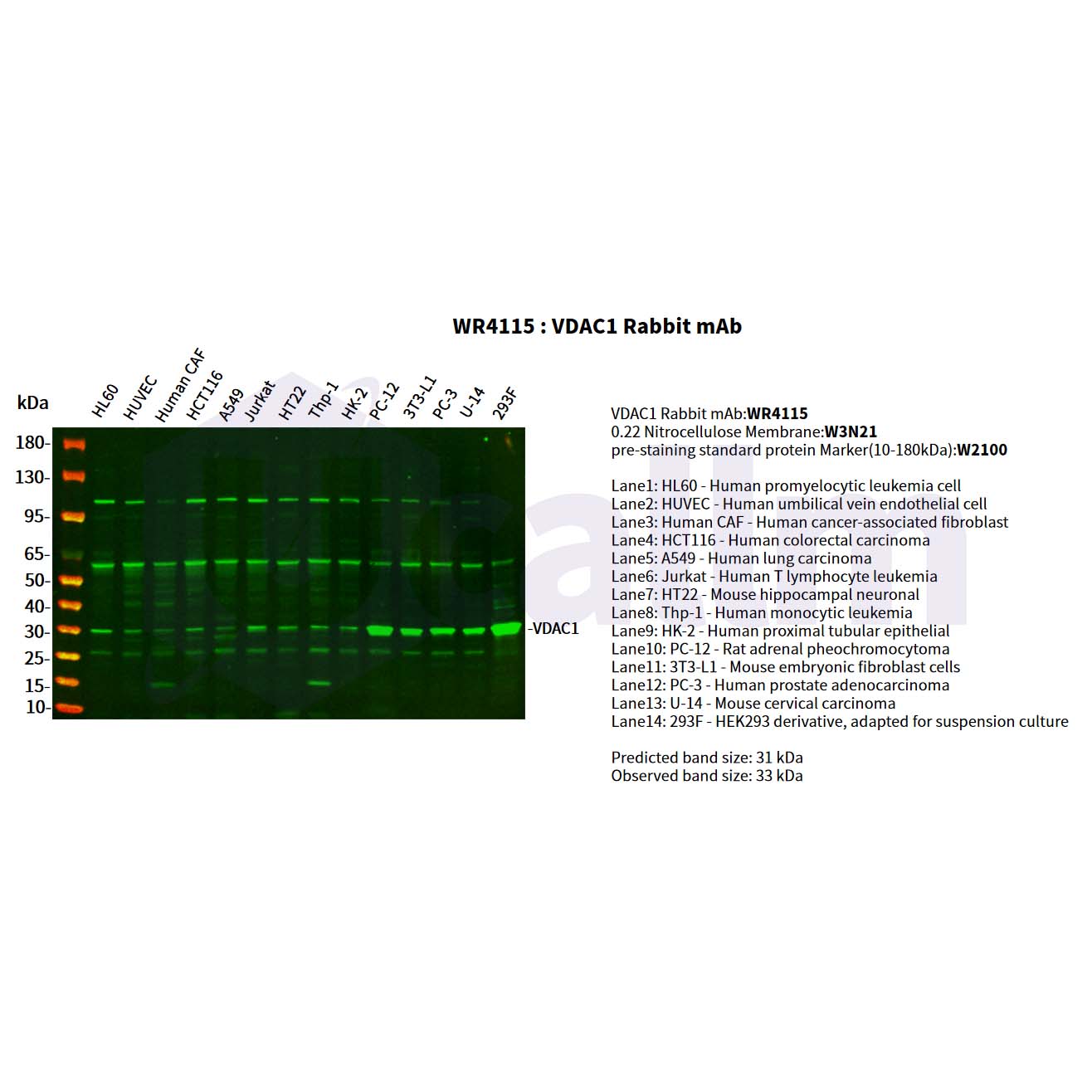 WR4115 Various whole cell lysates were separated by 4-20% SDS-PAGE, and the primary antibody was used at 4°C, over night with a 1:2500 dilution . The Dylight 800-conjugated Goat anti-Rabbit antibody(Cat:WS0446) was used to detect the antibody. Various whole cell lysates were separated by 4-20% SDS-PAGE, and the primary antibody was used at 4°C, over night with a 1:2500 dilution . The Dylight 800-conjugated Goat anti-Rabbit antibody(Cat:WS0446) was used to detect the antibody.