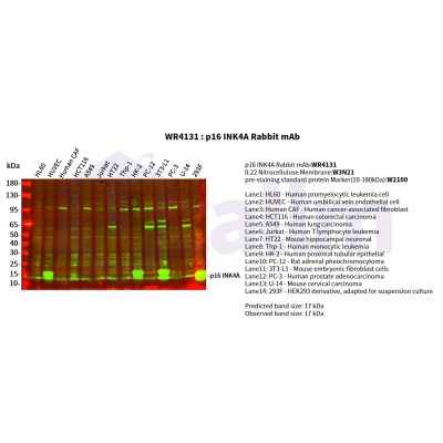 Various whole cell lysates were separated by 4-20% SDS-PAGE, and the primary antibody was used at 4°C, over night with a 1:5000 dilution . The Dylight 800-conjugated Goat anti-Rabbit antibody(Cat:WS0446) was used to detect the antibody.