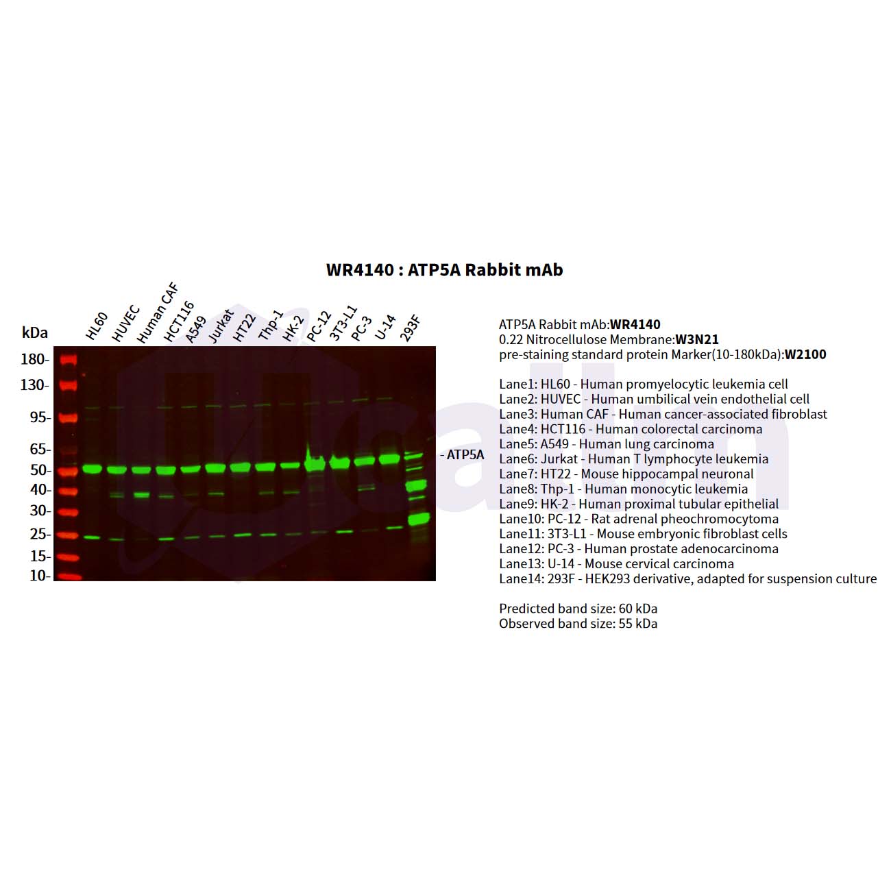 WR4140 Various whole cell lysates were separated by 4-20% SDS-PAGE, and the primary antibody was used at 4°C, over night with a 1:5000 dilution . The Dylight 800-conjugated Goat anti-Rabbit antibody(Cat:WS0446) was used to detect the antibody. Various whole cell lysates were separated by 4-20% SDS-PAGE, and the primary antibody was used at 4°C, over night with a 1:5000 dilution . The Dylight 800-conjugated Goat anti-Rabbit antibody(Cat:WS0446) was used to detect the antibody.