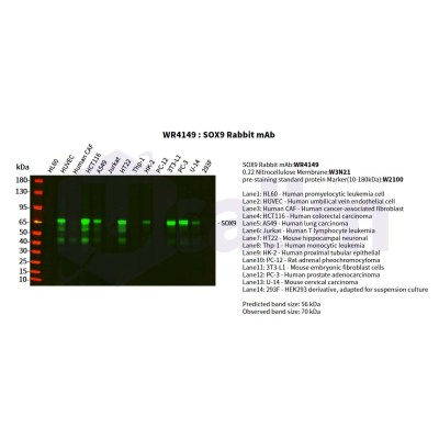 Various whole cell lysates were separated by 4-20% SDS-PAGE, and the primary antibody was used at 4°C, over night with a 1:1000 dilution . The Dylight 800-conjugated Goat anti-Rabbit antibody(Cat:WS0446) was used to detect the antibody.