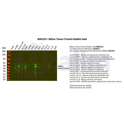 Various whole cell lysates were separated by 4-20% SDS-PAGE, and the primary antibody was used at 4°C, over night with a 1:2500 dilution . The Dylight 800-conjugated Goat anti-Rabbit antibody(Cat:WS0446) was used to detect the antibody.