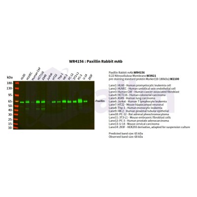Various whole cell lysates were separated by 4-20% SDS-PAGE, and the primary antibody was used at 4°C, over night with a 1:2500 dilution . The Dylight 800-conjugated Goat anti-Rabbit antibody(Cat:WS0446) was used to detect the antibody.