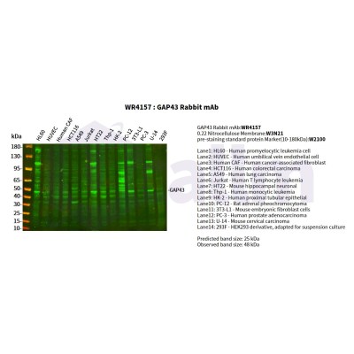 Various whole cell lysates were separated by 4-20% SDS-PAGE, and the primary antibody was used at 4°C, over night with a 1:5000 dilution . The Dylight 800-conjugated Goat anti-Rabbit antibody(Cat:WS0446) was used to detect the antibody.