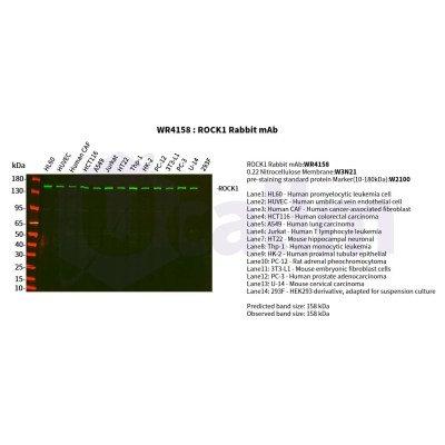 Various whole cell lysates were separated by 4-20% SDS-PAGE, and the primary antibody was used at 4°C, over night with a 1:2500 dilution . The Dylight 800-conjugated Goat anti-Rabbit antibody(Cat:WS0446) was used to detect the antibody.