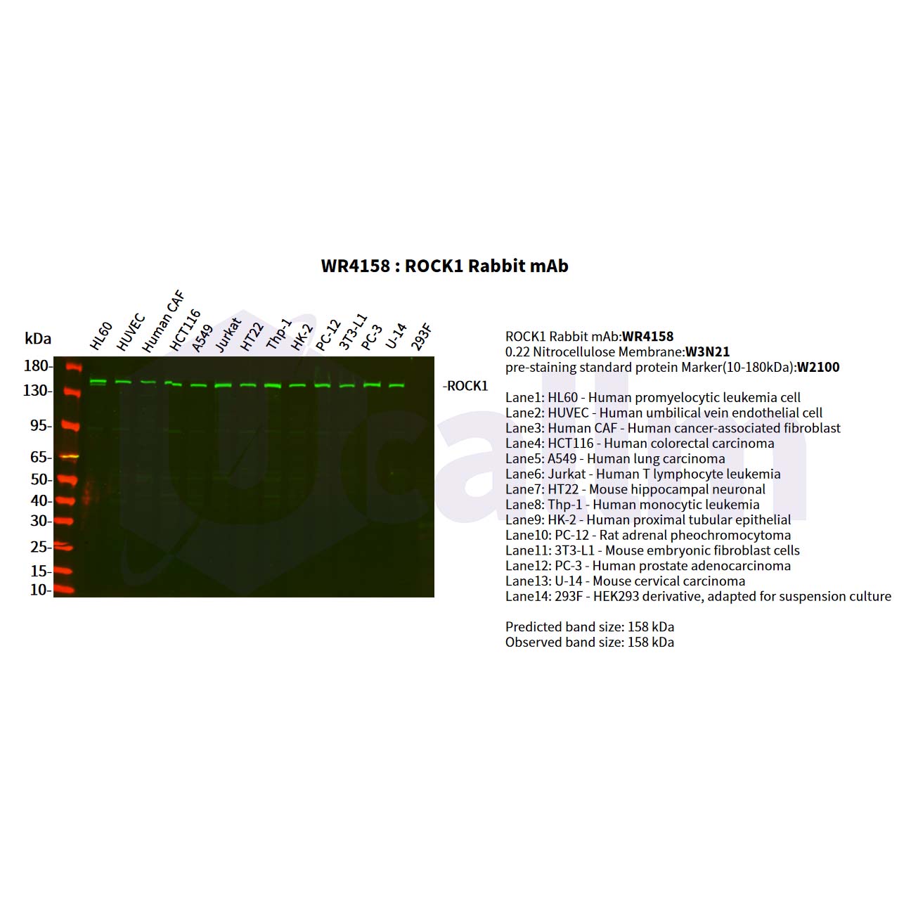 WR4158 Various whole cell lysates were separated by 4-20% SDS-PAGE, and the primary antibody was used at 4°C, over night with a 1:2500 dilution . The Dylight 800-conjugated Goat anti-Rabbit antibody(Cat:WS0446) was used to detect the antibody. Various whole cell lysates were separated by 4-20% SDS-PAGE, and the primary antibody was used at 4°C, over night with a 1:2500 dilution . The Dylight 800-conjugated Goat anti-Rabbit antibody(Cat:WS0446) was used to detect the antibody.