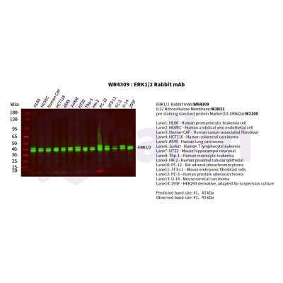 Various whole cell lysates were separated by 4-20% SDS-PAGE, and the primary antibody was used at 4°C, over night with a 1:5000 dilution . The Dylight 800-conjugated Goat anti-Rabbit antibody(Cat:WS0446) was used to detect the antibody.