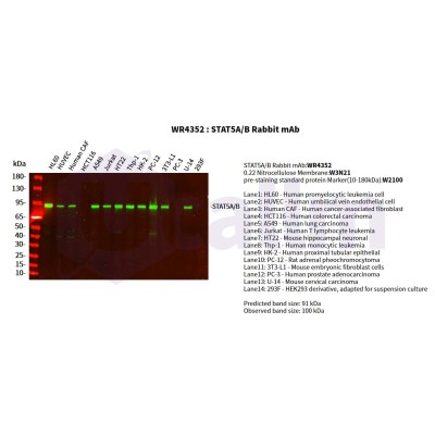 Various whole cell lysates were separated by 4-20% SDS-PAGE, and the primary antibody was used at 4°C, over night with a 1:5000 dilution . The Dylight 800-conjugated Goat anti-Rabbit antibody(Cat:WS0446) was used to detect the antibody.