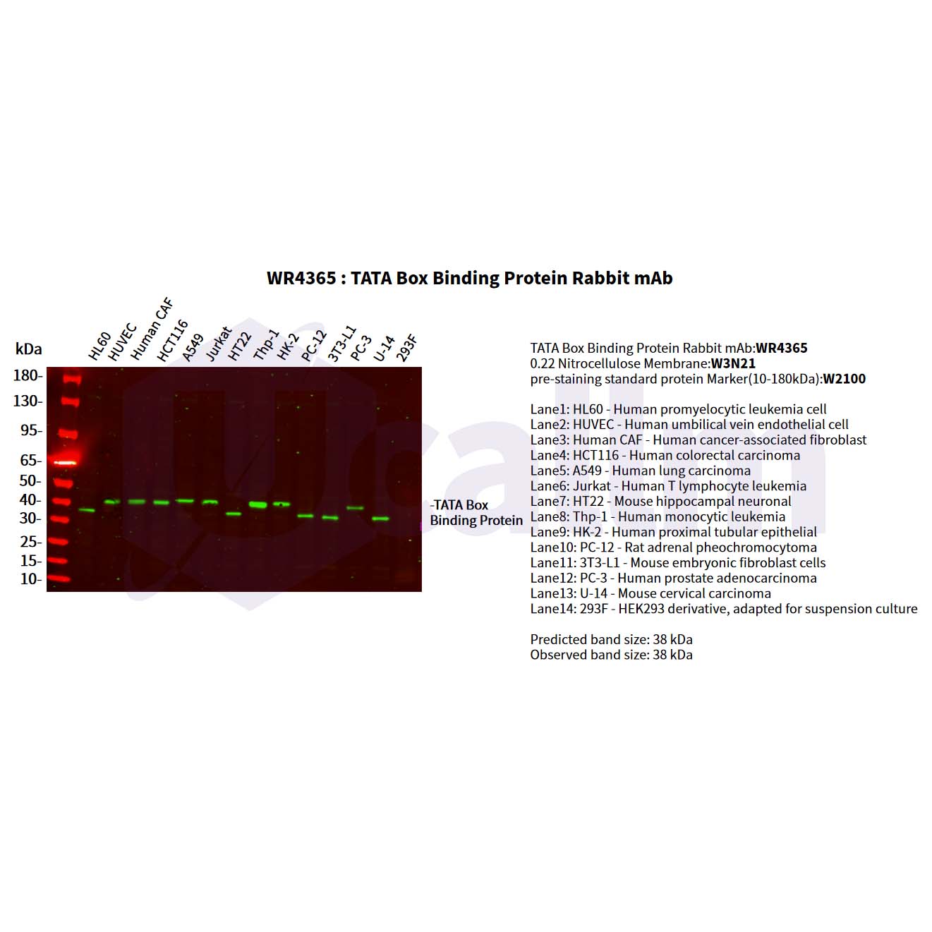 WR4365 Various whole cell lysates were separated by 4-20% SDS-PAGE, and the primary antibody was used at 4°C, over night with a 1:2000 dilution . The Dylight 800-conjugated Goat anti-Rabbit antibody(Cat:WS0446) was used to detect the antibody. Various whole cell lysates were separated by 4-20% SDS-PAGE, and the primary antibody was used at 4°C, over night with a 1:2000 dilution . The Dylight 800-conjugated Goat anti-Rabbit antibody(Cat:WS0446) was used to detect the antibody.