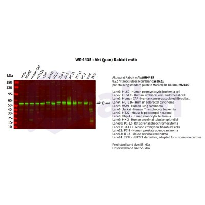 Various whole cell lysates were separated by 4-20% SDS-PAGE, and the primary antibody was used at 4°C, over night with a 1:5000 dilution . The Dylight 800-conjugated Goat anti-Rabbit antibody(Cat:WS0446) was used to detect the antibody.