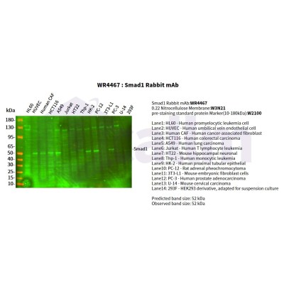 Various whole cell lysates were separated by 4-20% SDS-PAGE, and the primary antibody was used at 4°C, over night with a 1:2500 dilution . The Dylight 800-conjugated Goat anti-Rabbit antibody(Cat:WS0446) was used to detect the antibody.